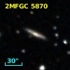 2MFGC 5870